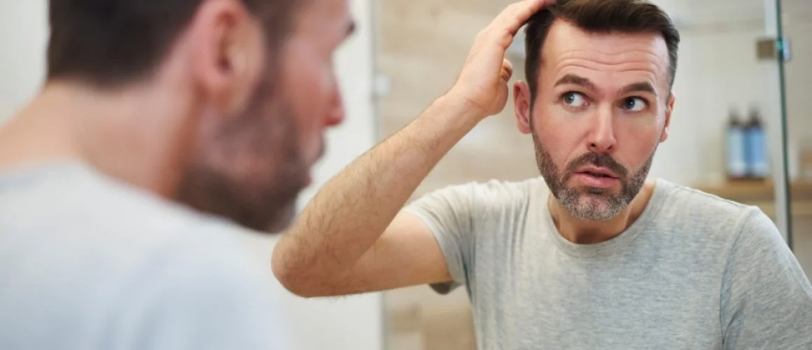 hair loss clinic in singapore explores hair loss in men