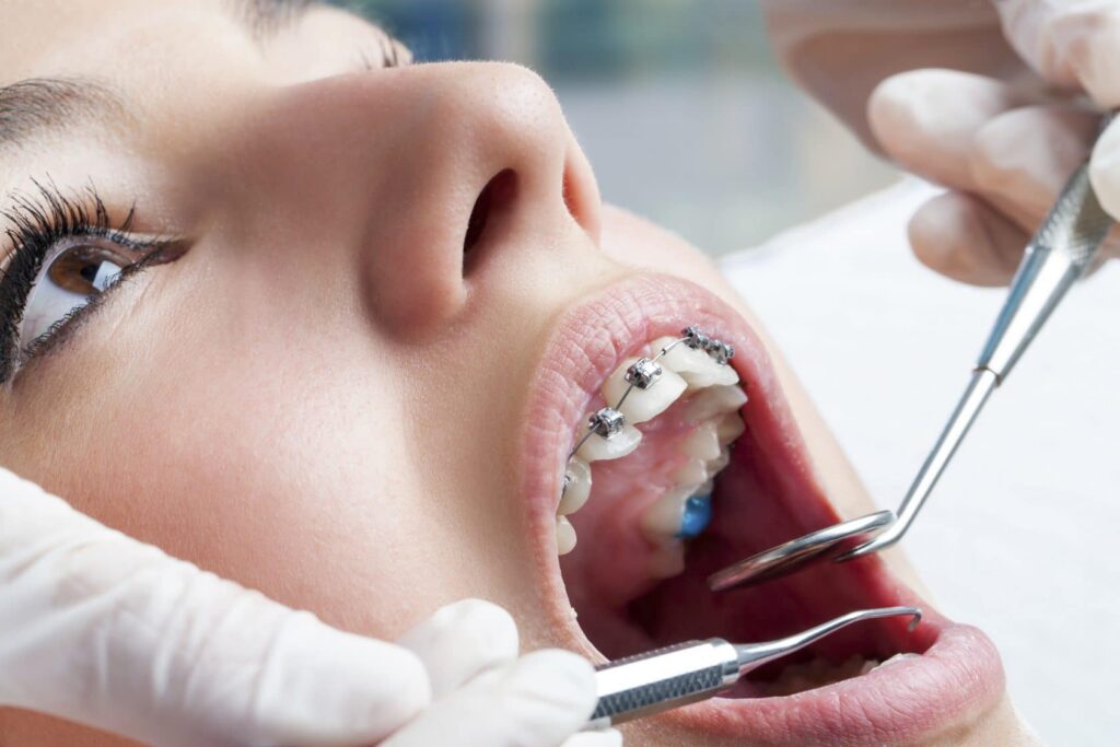 The Role of Orthodontic Care